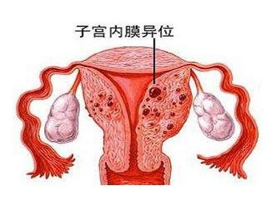 2.1 子宫内膜的恢复机制