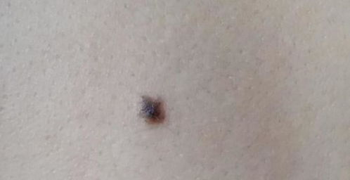 （三）不规则形态及边缘缺陷