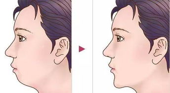 女孩子下巴有坑面相代表什么含义？