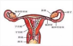 2. 输卵管通液术