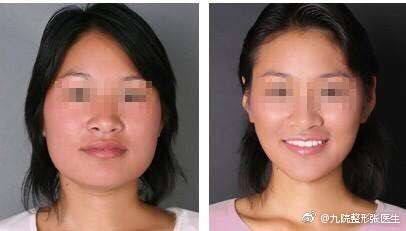 四、 面部轮廓——立体感与社交信任度的关联