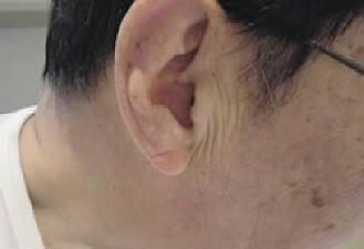 （二）佛门及耳门宽