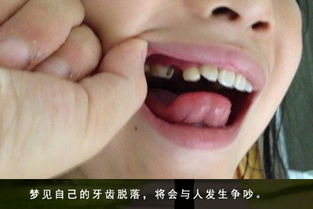 孕妇梦见牙齿掉光的象征意义
