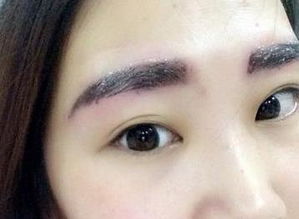 眉毛磕破凹痕怎么快速修复或恢复？