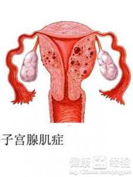 3. 子宫内的病症：潜伏的隐患