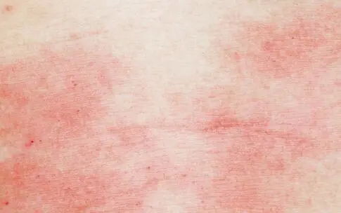 2.1 荔枝及其致敏潜嫩