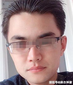 二、 印堂饱满与贵气之关联