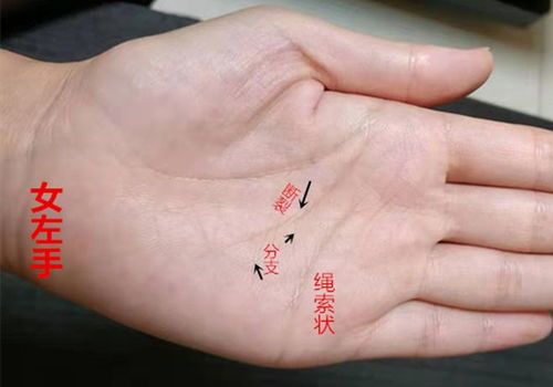 2.1 足趾比例异常延伸的形态学解读