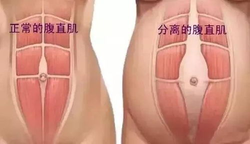 五、平坦的腹部：智慧与创意的结晶
