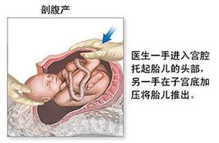 一、手术流程与时间段基准