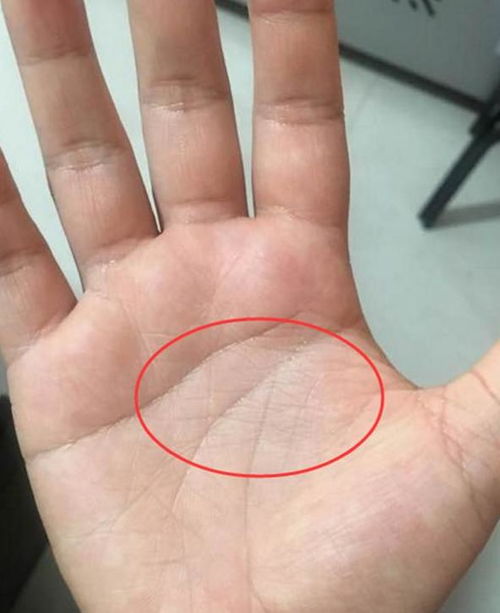 背部绿色胎记图案女士手相，圆形纹路在手相中具体代表什么含义？