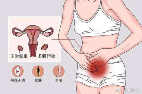 保持身体健康状况的生活方式