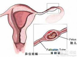 最后再来看的一些提议...
