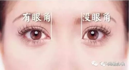 开眼角的风水原理是什么？风水眼睛图解大全有哪些？