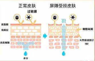 五行缺水如何同过饮食、居住环境等方法有效补水？