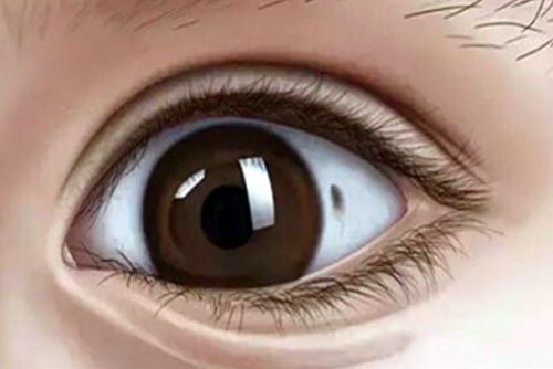 神秘的眼白黑点大揭秘