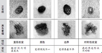 三、 形状与结构的判别要点