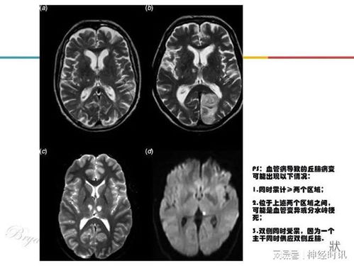 二、 定位特征及手相学归类体系解读