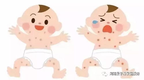 一、 高致敏性蛋白质类食物成分的系统性规避