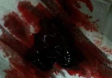 孕妇梦到屎预示着什么征兆？