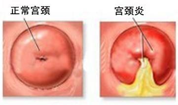 四、 月经周期—失调与异常并存