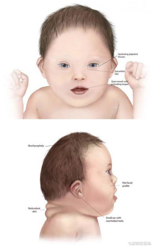 面相与遗传：先天因素的影响