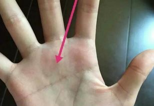 手指变粗代表什么？如何改善手指骨变粗的情况？