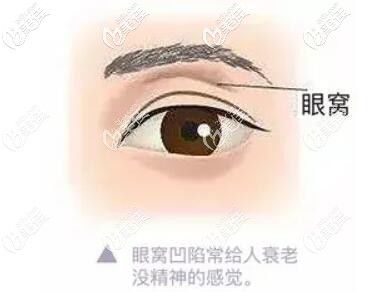 第一章：眼窝凹陷的成因分析——先天禀赋与后天耗损的二元互动