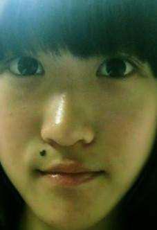 一、  媒婆痣的空间定位与几何界定