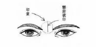 1. 眼色与眼白