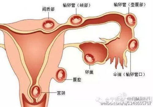 除了怀孕还有啥毛病让阿姨不来拜访？