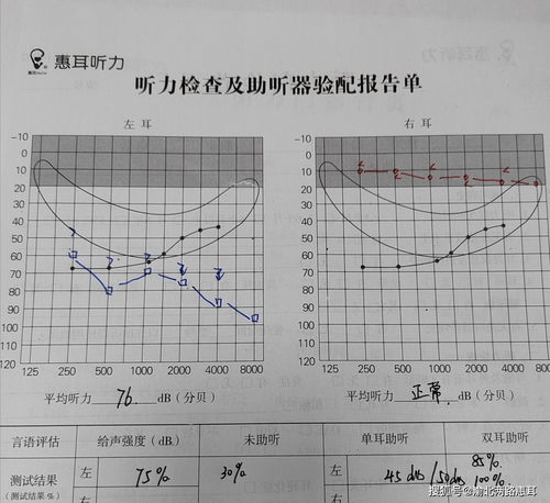 左右耳耳鸣分别预示什么吉凶？