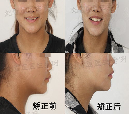 三、  技术干预与命运重塑：现代口腔医学的破局之道