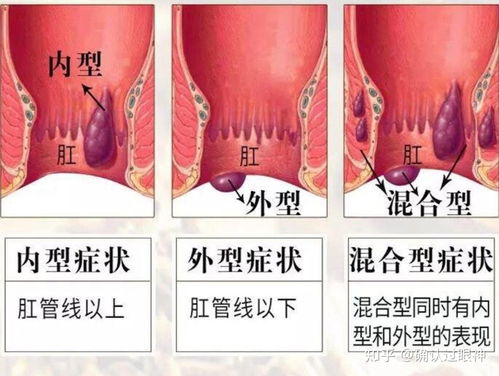 六、 必不可更少时求医—专业诊疗才是真实正方案!