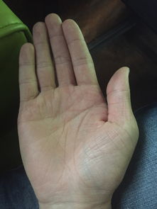 手相男手指竖纹多是什么原因？