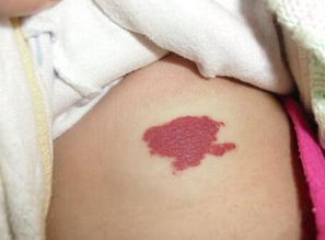 2. 乳房部位：子嗣缘分与生产健康的隐喻