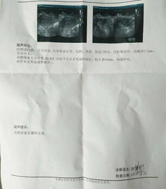 孕酮检测