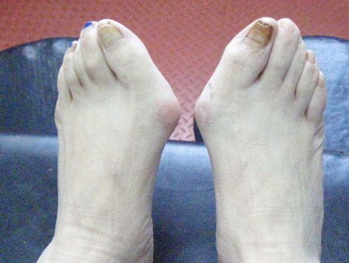 梦见死人脚出血是什么预兆或含义？