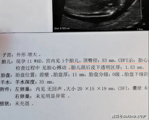 2. 风水格局对孕育运势的影响