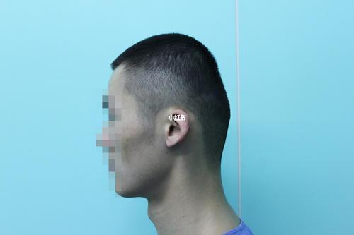 后脑勺扁平的人命运真的不好吗？他们的命运究竟如何？