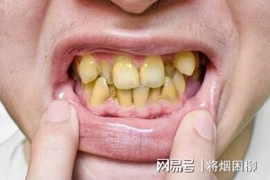 （二）对语音、 面部美观及心理状态身体健康状况的作用于