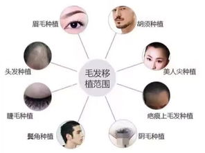 1．毛发移植（植发）手术