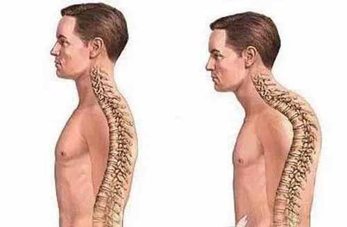 三、 体态臃肿——胖而无收