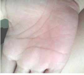 女人右手全是斗的手相，命运图解大全有哪些详细解读？