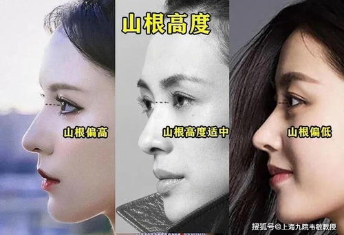 鼻子沟敞口面相中，哪一面相更佳？鼻子下方有小洞如何改善面相？