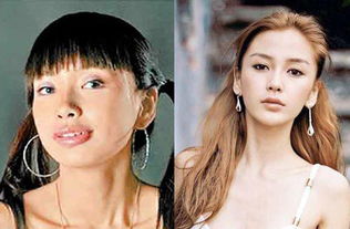 额头饱满度与智力、 威严及婚姻宫位的关联性分析