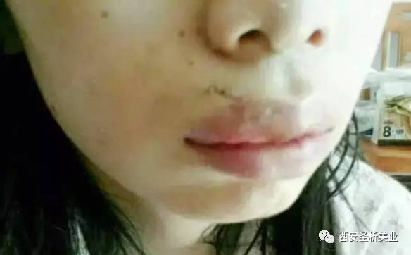 1. 自尊心受损与情绪困扰