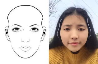 三、 疤痕、凹陷及痣纹所携带的命运暗示