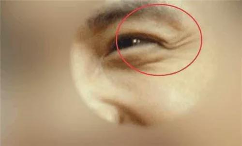 男人笑起来鱼尾纹明显，这面相代表什么含义？