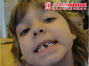 为什么我总是Zuo梦梦见牙齿掉了？